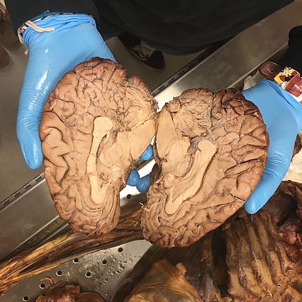 Brain Image