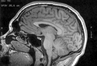 brain heart